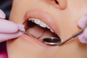 a patient undergoing a dental procedure 300x201 - a patient undergoing a dental procedure