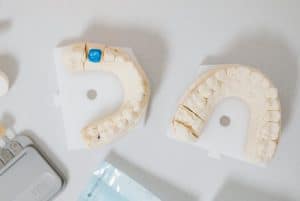 dental teeth cast model 300x201 - dental teeth cast model