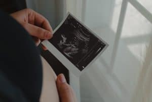 hand holding an ultrasound 300x201 - hand holding an ultrasound